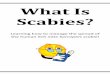 What Is Scabies? - Gila River Health Caregrhc.org/wp-content/uploads/2017/01/scabies-pamphlet.pdf · 2017-01-18 · IMPORTANT Scabies is a human itch mite infection that causes a