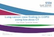 Lung cancer case finding in COPD using low-dose CT · Part of: South Tyneside and Sunderland Healthcare Group Lung cancer case finding in COPD using low-dose CT The South Tyneside