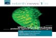 rebirth news 1 · What effect does laser nanosurgery have on cells? To enhance understanding of how femtosecond laser nanosurgery affects cells, REBIRTH researchers used this technique