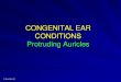 CONGENITAL EAR CONDITIONS Protruding Auricles · Lateral view, showing the excessive cartilage depth. Bruce Black MD Postero-lateral view showing the extent of protrusion and