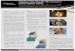 OrthoCam: Using Wearable Video Cameras to Improve …...OrthoCam: Using Wearable Video Cameras to Improve Resident Training Randy Beard MD, Kamran Hamid MD, MPH, Jason Lang MD Department