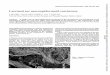 Lacrimal sac mucoepidermoid carcinoma · BritishJournalofOphthalmology, 1986,70, 681-685 Lacrimalsacmucoepidermoidcarcinoma J BLAKE,' JOAN MULLANEY,' AND J GILLAN2 Fromthe 'RoyalVictoria