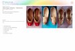 Sherwani Shoes - Varanasi · Digital Learning Environment for Design - 3 Apart from being called as ‘Juttis’ or ‘Mojari’ sherwani shoes have an alternative name called Khussa