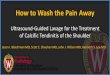 How to Wash the Pain Away - UW Radiology...How to Wash the Pain Away Ultrasound-Guided Lavage for the Treatment ... effective, and relatively simple procedure utilizing readily available