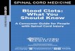 BLOOD CLOTS Blood Clots: What You Should Know...Consumer Guide: Blood Clots: What You Should Know | 3Back to Table of Contents Treating blood clots • Blood clots are treated with