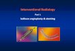 Prezentacja programu PowerPointradiologia-zabiegowa.pl/download/eng_div/interventional_radiology.pdf · Interventional Radiology Part I: balloon angioplasty & stenting. Seldinger