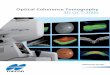 Optical Coherence Tomography 3D OCT-2000 · Compare Function High-resolution B-scan Retina With Topcon’s advanced technologies, indulge yourself in high performance Exclusive 3D