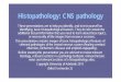 Histopathology: CNS pathology - Rated Medicine · Histopathology: CNS pathology These presentations are to help you identify, and to test yourself on identifying, basic histopathological