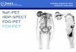 NaF-PET HDP-SPECT FDG-PET FCH-PET...NaF-PET HDP-SPECT FDG-PET FCH-PET Thursday, August 30, 2012 Session 5, 9:30-10:00 Purpose of bone imaging • 50% of cancer patients • Prostate,