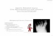 Sports Related Injury Disc Biomechanics and Lesions · Sports Related Injury Disc Biomechanics and Lesions Terry R. Yochum DC, DACBR, Fellow, ACCR ... •Best for bony anatomy- fractures