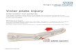Volar plate injury - King's College Hospital - 858.1 - volar plate injury.pdf · Volar plate injury . Information for patients This leaflet explains more about volar plate injury