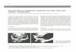 Choroid Plexus Papilloma: Detection by Real-Time and ... Choroid Plexus Papilloma: Detection by Real-Time