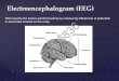 Electroencephalogram (EEG)web.eng.fiu.edu/mcabre05/DATA FOR PROJECTS/class... · Electroencephalogram (EEG) EEL ... Electroencephalography is generally defined as the neurophysiologic
