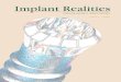 Implant Realities - Dr. Ellie Kheirkhahi-Love DDS, MSD · Implant Realitieswill explore all phases of implant dentistry, from treatment planning of simple and complex cases, through