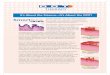 THERAPYjriegermd.com//DOT Laser Technology Brochure.pdfTHERAPY The SmartXide DOTTM CO 2 laser, used for performing DOT TherapyTM skin rejuvenation, has the ideal pulse characteristics