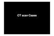 CT scan Cases · Deep neck infection. Title: Microsoft PowerPoint - CT case Author: Administrator Created Date: 5/24/2012 10:25:51 AM 