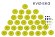 KVIZ-EKG - mednet.mkInterpretacija 1 EKG 1:The rhythm is sinus rhythm with a rate of 80/minute. The PR interval is 130 ms. The Q waves in II, III, aVF are diagnostic of an inferior