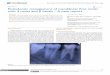 Endodontic management of mandibular first molar …medcraveonline.com/JDHODT/JDHODT-09-00347.pdfThe diagnosis was done as chronic apical periodontitis due to pulpal necrosis, of the