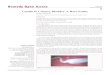 Candle in Urinary Bladder- A Rare Entity · The ultrasound screening of the urinary bladder revealed a floating linear echogenic foreign . body. The patient was planned for cystoscopy