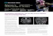 Advances in - Cleveland Clinic · tary paraganglioma-pheochromocytoma syndrome. In a multidisciplinary effort, otolaryngologists in Cleveland Clinic’s Head & Neck Institute are