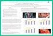 Effective Epicardial Treatment of Functional Mitral ... · Effective epicardial treatment of functional mitral regurgitation with BACE™ in experimental animals . Megumi Matheson,