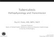 Tuberculosis · • Historical Context of Tuberculosis (TB) ... – People co-infected with TB/HIV are 21-34 times more likely to develop ... – Diabetes – Smoking – Existing