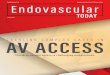 TACKLIG OMPLE A SE S I AV ACCESS · ulnar, or interosseous arteries, it is also the treatment of choice for patients who have severe occlusive disease in the proximal portion of these