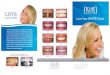 Before After - ProSites, Inc.c2-preview.prosites.com › 135643 › wy › docs › KoR Brochure.pdf · 2013-02-27 · renowned cosmetic dentist and whitening science expert Dr. Rod