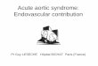 Acute aortic syndrome: Endovascular contribution€¦ · Acute aortic syndrome Acute aortic syndrome contribute significantly to the high overall mortality from cardiovascular disease