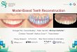 Model-Based Teeth Reconstructiongvv.mpi-inf.mpg.de/teaching/gvv_seminar_2019/slides/... · 2017-05-15 · Michael Zollhöfer Model-Based Teeth Reconstruction 20 Medical Dentistry