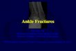 Tips and Tricks for Ankle and Calcaneus › media › 389006 › Ankle-Fractures-Yoon.pdf · Ankle Fractures Pat Yoon, MD. Minneapolis Veterans Affairs Medical Center. ... Disclosures
