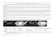 COMPARATIVE STUDY OF SSFP LUNG MRI AT 1.5T WITH HIGH ... · Interstitial lung disease is characterised by inflammation and scarring of the pulmonary interstitium leading to increased