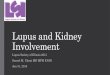 Lupus and Kidney Involvement · Lupus and Kidney Involvement Lupus Society of Illinois 2015 ... regarding both diagnosis and treatment is the best way to develop a well-tolerated