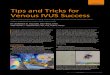 Tips and Tricks for Venous IVUS Success · patients with pelvic vein obstruction. It provides safe, accu-rate, and reproducible information that prevents under- or overtreating patients,