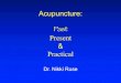 Acupuncture Past Present and Practical...pain, frozen shoulder, or various osteoarthritic joint pains, especially when pain is worsened by damp and cold weather. Pain-Relief Guide: