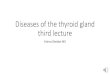 Diseases of the thyroid gland third lecture...-It is characterized by gradual thyroid failure secondary to autoimmune destruction of the thyroid gland.-It is most prevalent between