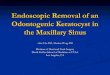 Endoscopic Removal of an Odontogenic Keratocyst …...2011/01/26  · Keratocyst in Maxillary Sinus with Invasive behaviour. J Oral Pathol Med. 2006 Apr;35(4):249-51. Cioffi GA, Terezhalmy