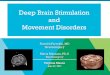 Deep Brain Stimulation and Movement Disorders › wp-content › uploads › ...DBS on tremor • 1990s Laitinen DBS to Gpi for parkinsons • 1994 Pollack and collegues demonstrated