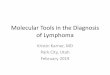 Molecular Tools in the Diagnosis of LymphomaMALT lymphoma • Marginal zone (Mucosa associated lymphoid tissue) lymphoma –Low grade B-cell lymphoma –Some relationship to underlying