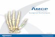 Surgical Technique...METACARPAL IMPLANTS Catalog# Description QTY 120-12530 Small Metacarpal Implant – 4.0mm x 30mm 2 120-22530 Medium Metacarpal Implant – 5.0mm x 30mm 2 120-32530
