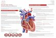 Arrhythmia Alliance Stratford upon Avon Warwickshire CV37 ... · “plumbing problem, SCA is more of an “electrical problem” that prevents the heart from functioning effectively