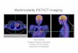 Multimodality PET/CT ImagingTraditional measures: Resolution • Point-spread function (PSF): Narrower is better • Modulation transfer function (MTF), which is the absolute value