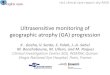 Ultrasensitive monitoring of geographic atrophy …inviewmedical.pl/.../2015/08/M-RCC-011-a4.3-GA-XV-XX.pdfUltrasensitive monitoring of geographic atrophy (GA) progression K . Gocho,