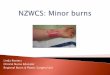 Linda Roeters Clinical Nurse Educator Regional Burns ...€¦ · NZ: Minor burns is a superficial or partial thickness burn with a TBSA of