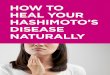 HOW TO HEAL YOUR HASHIMOTO’S DISEASE NATURALLY€¦ · fight fatigue and help to heal a leaky gut All of these benefits have a direct impact on boosting your immune system, and