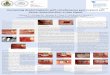 Poster # 159 Uncovering dental implants with simultaneous ... · A systematic review of post-extractional alveolar hard and soft tissue dimensional ch anges in humans. Clinical Oral