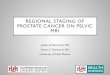 Regional Staging of Prostate cancer with mri · patients with prostate cancer: a meta-analysis." Clinical radiology63.4 (2008): 387-395. 5. Jager, GerritJ., et al. "Pelvic adenopathy