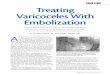 COVER STORY Treating Varicoceles With Embolization · 2015-05-14 · 2 I ENDOVASCULAR TODAY IAPRIL 2009 COVER STORY Figure 2. A venogram after occluding the two main inguinal channels