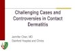Challenging Cases and Controversies in Contact Dermatitis Systemic Allergic Contact Dermatitis = Dermatitis