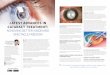 LATEST ADVANCES IN CATARACT TREATMENT: …...CATARACT TREATMENT: M dm X, a 57 year lady, noticed blurring of vision in both eyes for a few months. She saw Dr Leonard Ang, who found